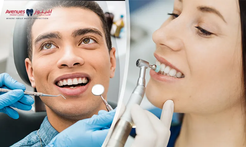Dental Scaling & Polishing + Consultation!